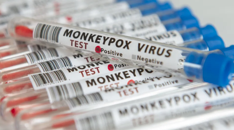 Variole du singe : Moroni active son plan de prévention