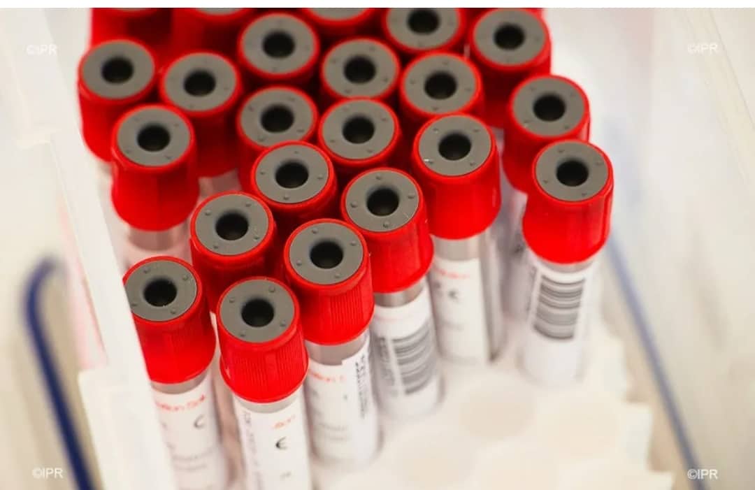 Un cas de variole de singe à Mayotte: Une réunion d’urgence à Moroni