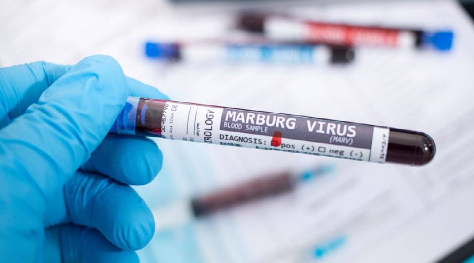 Virus Marburg en Tanzanie :  Le pays suit de près la situation