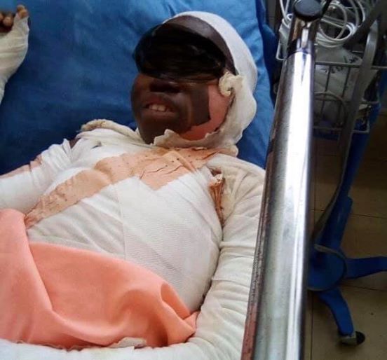 image La fille de 10 ans brulée par sa mère est décédée dans son lit d’hôpital